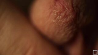 Skin MASCULAR