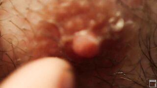 Skin MASCULAR